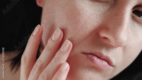 Skin with enlarged pores close-up. The woman touches the skin of her face, examining it. photo