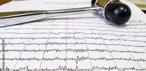 Electroencephalogram and neurological hammer are on the table at the practicing doctor photo