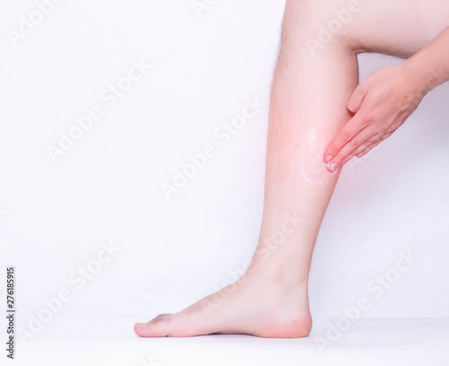 A man rubs a medical ointment in the damaged leg and calf muscle  a healing cream for stretching the ligaments and against inflammation  pain relief  copy space