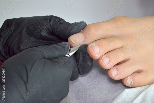 A pedicure master in black gloves works with tweezers on a girl nails, trimmed pedicure, cuticle trimming