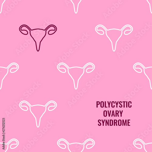 Polycystic ovary syndrome awareness poster with pattern of uterus symbol on pink background. Ovarian disease symbol. Medical disorder concept. Vector illustration.