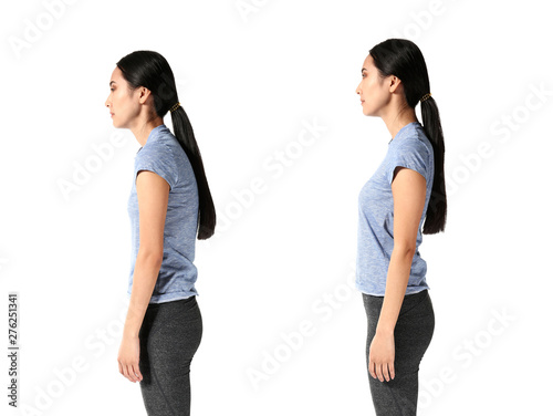 Asian woman with poor and good posture on white background photo