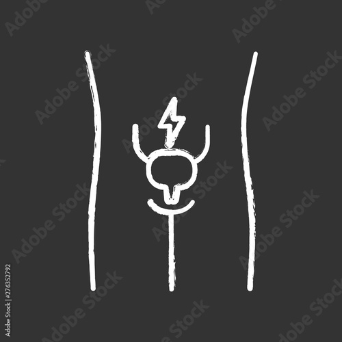 Ill urinary bladder chalk icon. Sore human organ. Cystitis. People disease. Unhealthy urinary system. Sick internal body part. Aching urinary tract. Isolated vector chalkboard illustration