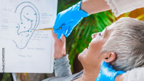Canvastavla Ear Acupuncture Point Therapy