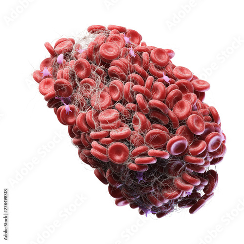 Photography 3d rendered medically accurate illustration of a blood clot