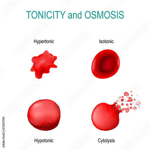 Tonicity is a measure of the osmotic pressure in red blood cells. isotonic, hypertonic; hypotonic, cytolysis photo