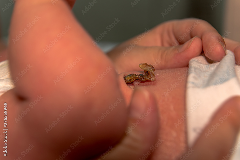 A young mother examines the umbilical cord of her newborn baby. Concept: health or newborn