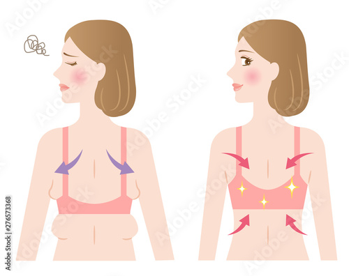 背中　わき肉　ビフォアアフター　女性