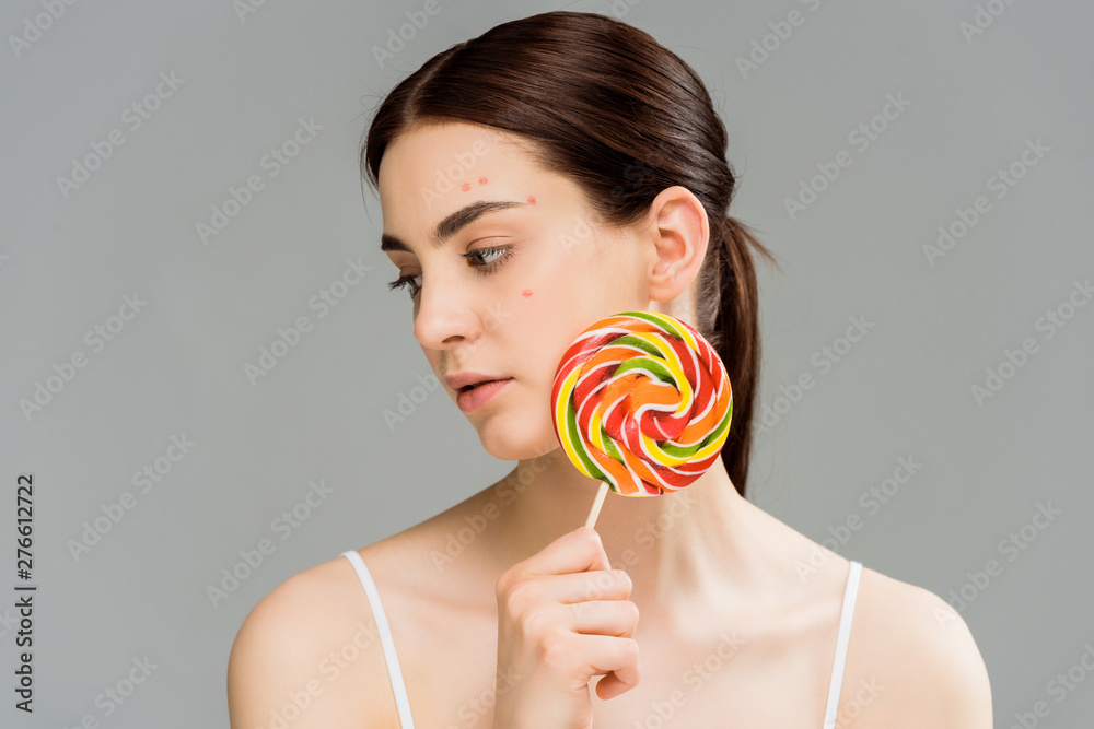 young brunette woman with acne on face holding sweet lollipop isolated on grey