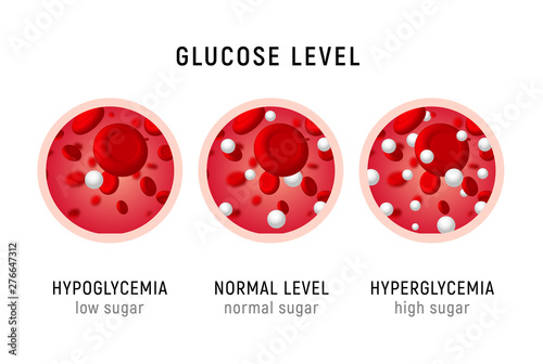 Glucose blood level sugar test. Diabetes insulin hypoglycemia or hyperglycemia diagram icon photo