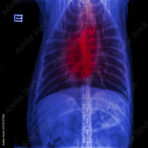 X-ray of dog anterior view closed up in thorax standard and chest with red highlight in respiratory system signs of pneumonia and bronchitis- veterinary medicine and Veterinary anatomy concept