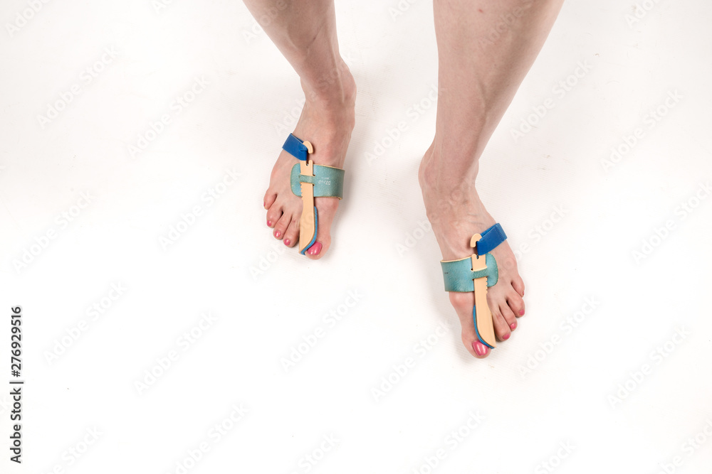 stabilizing orthosis for the correction of the big toe on the woman legs when hallux valgus, 2 legs, close-up isolated, white background stabilizing orthosis for the correction of the big toe on the woman legs when hallux valgus, 2 legs, close-up isolated, white background