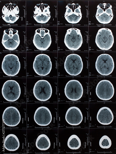 X-ray picture of the human body, medical