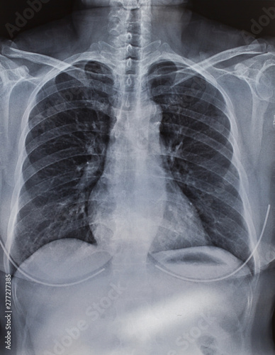 X-ray picture of the human body, medical
