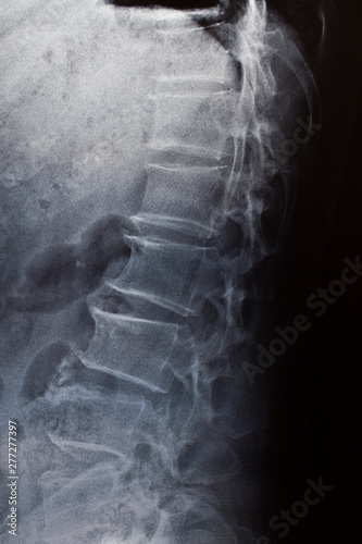 X-ray picture of the human body, medical