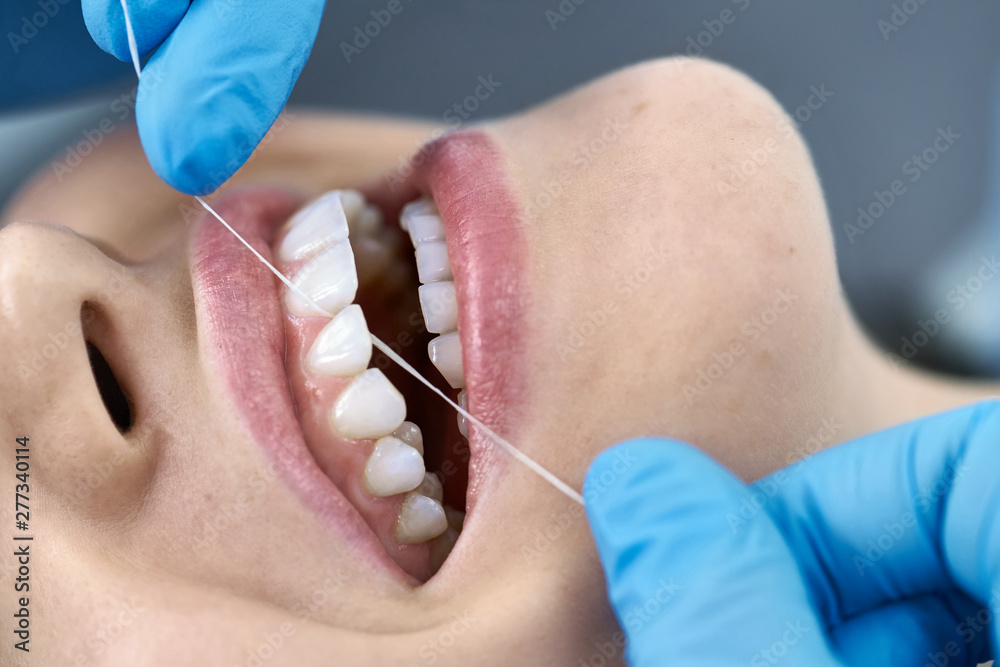 Pretty woman's teeth cleaning in dental clinic - obrazy, fototapety, plakaty 