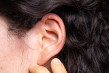 An extreme closeup view on the ear of a young Caucasian woman. She points towards her earlobe with her fingers. Small white spots are seen in the concha.