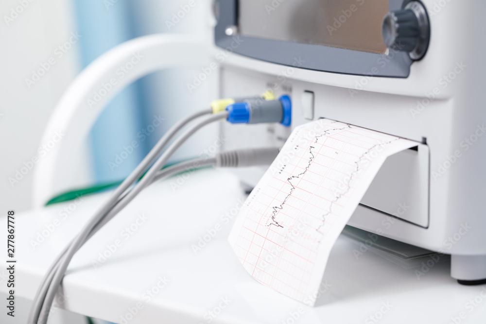 Electronic Fetal Monitor EFM performing Cardiotocography (CTG) monitoring fetal heartbeat close-up Electronic Fetal Monitor EFM performing Cardiotocography (CTG) monitoring fetal heartbeat close-up