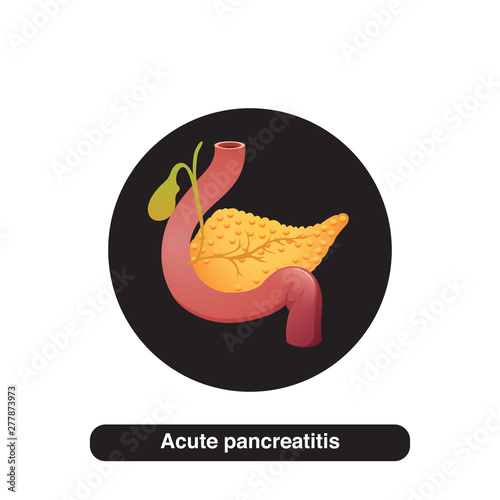 Acute pancreatitis illustration concept