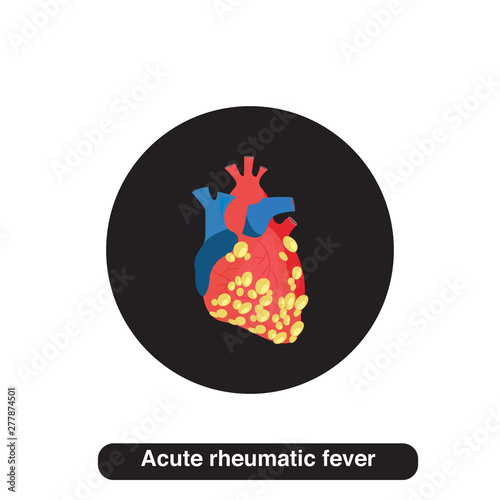 Acute rheumatic fever illustration concept