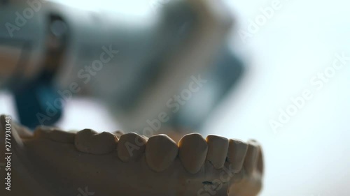 close up of the jaw block photo