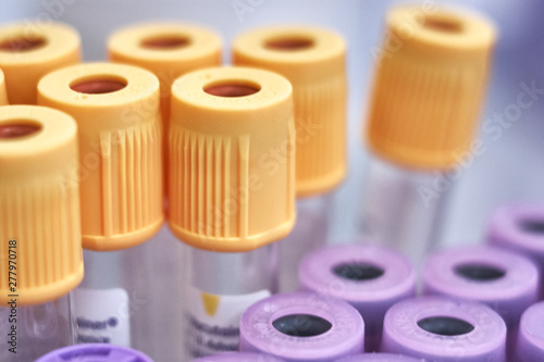 macro of test tubes with yellow top, against a gradient of white background. Selective focus