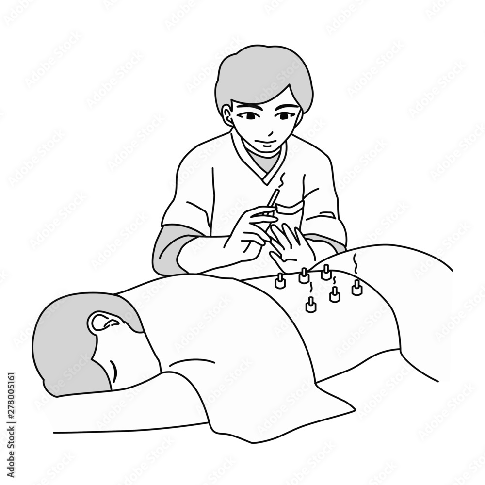 鍼灸院 灸 イラスト Stock Vector Adobe Stock
