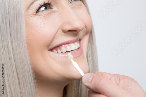 Close up of dentist using shade guide at woman s mouth to check veneer of teeth for bleaching