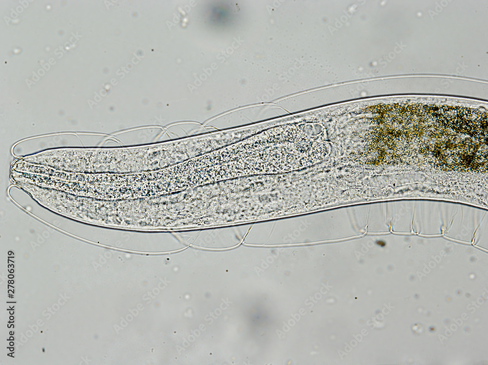 cat lung worm under the microscope Stock Photo Adobe Stock