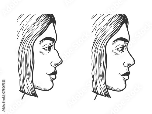 Woman face rhinoplasty sketch engraving vector illustration. Scratch board style imitation. Black and white hand drawn image.