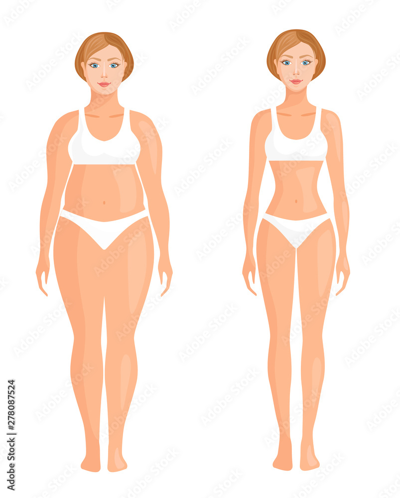 Thick and thin girl. Female figure before and after weight loss or plastic  surgery. Vector illustration in cartoon style. Banner on the topic of  weight loss, diet and healthy lifestyle. Stock Vector |