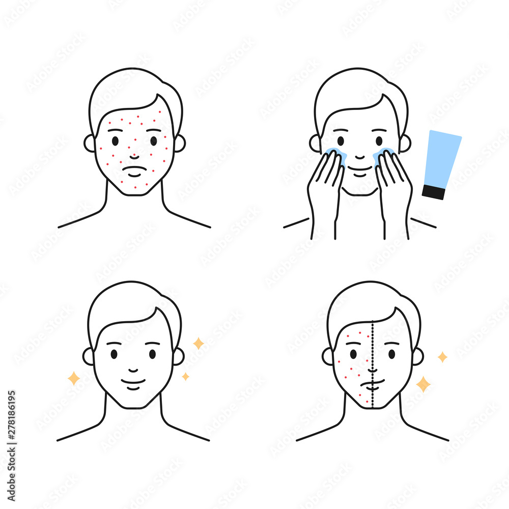 Acne problems and treatments male character outline vector icons Acne problems and treatments male character outline vector icons