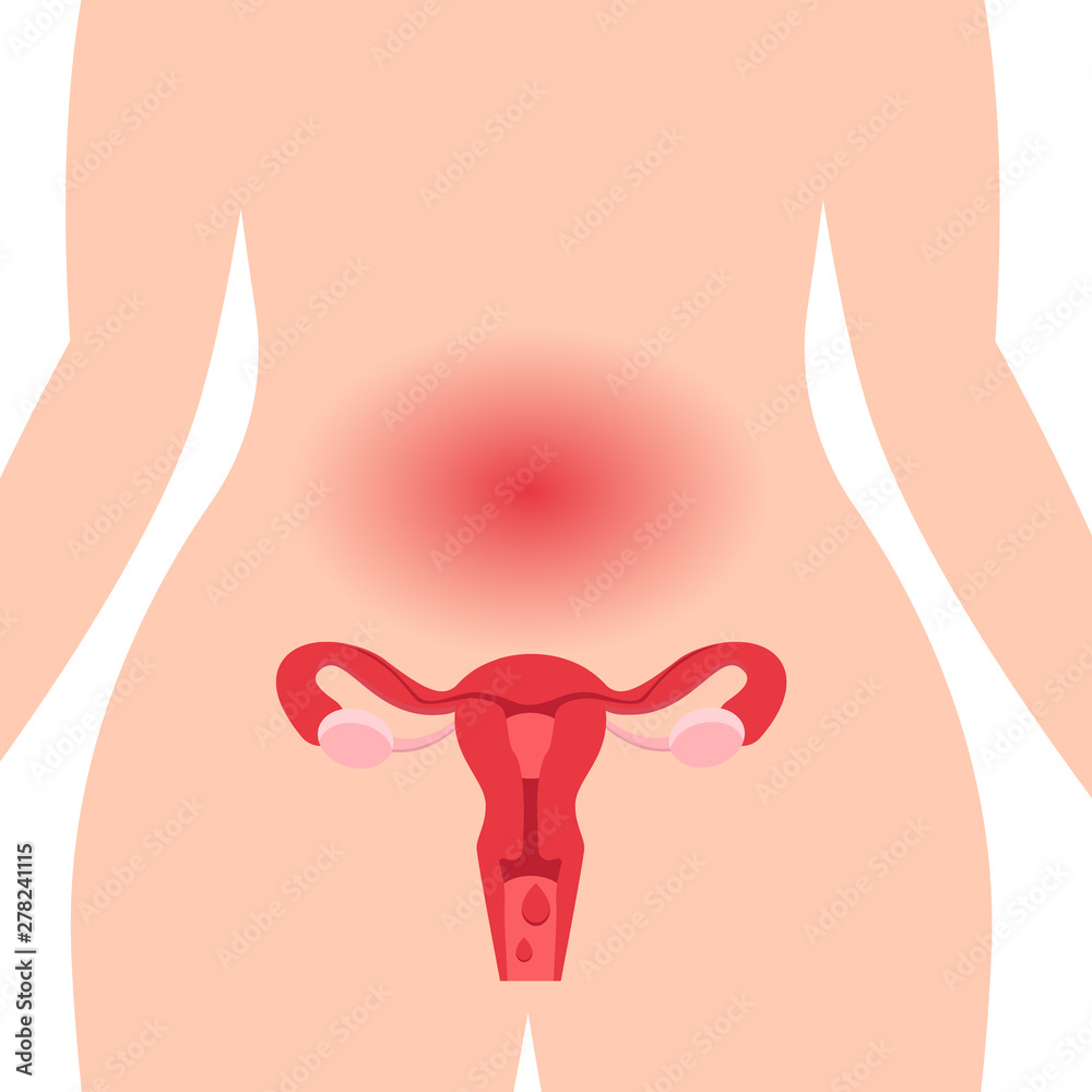 Gynecology. Medical illustration concept of healthy female reproductive system with the uterus and the ovaries. Abdominal pain during menstruation
