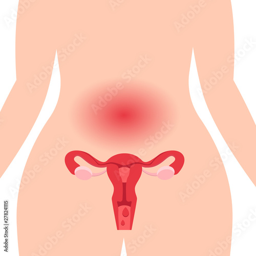 Gynecology. Medical illustration concept of healthy female reproductive system with the uterus and the ovaries. Abdominal pain during menstruation