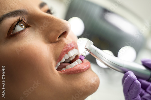 Closeup   teeth polishing procedure   closeup of beautiful young woman face 