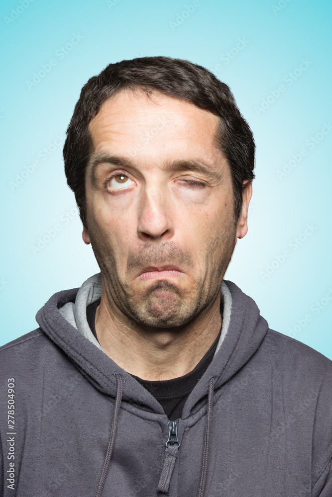Close-up of man with expression of forgetfulness Close-up of man with expression of forgetfulness