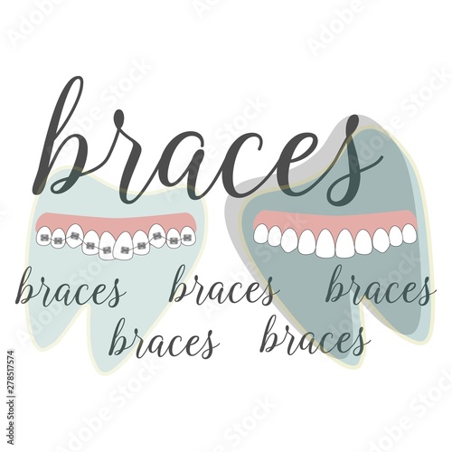 Braces dentistry in beautiful style. Vector flat design illustration.