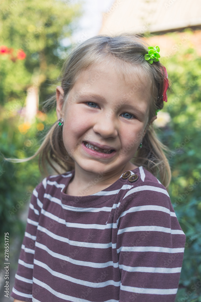 Child with a dental orthodontic device and without one tooth Child with a dental orthodontic device and without one tooth