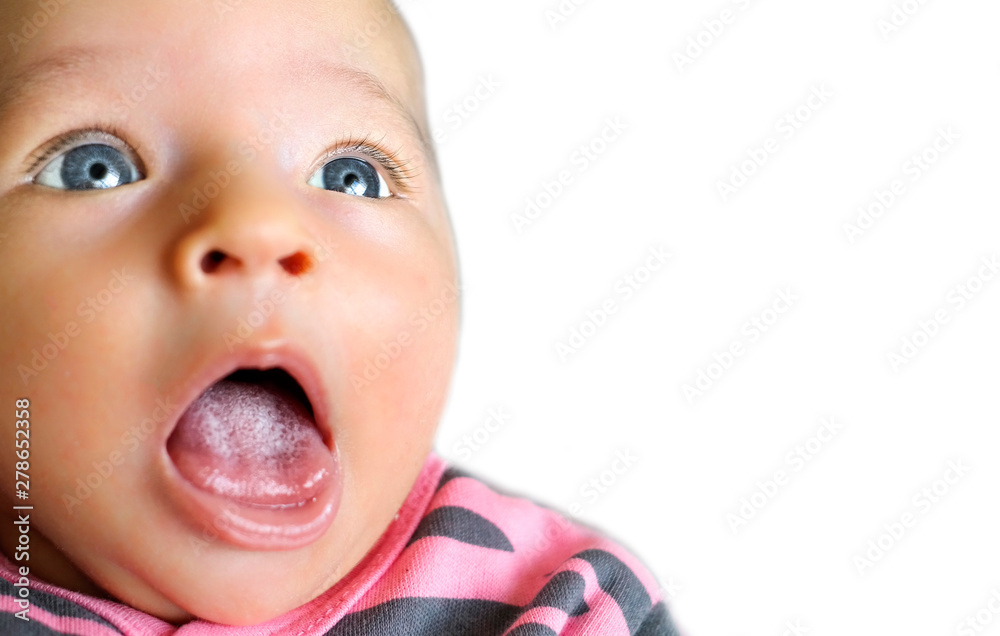 white crooked spots on baby tongue (Moniliazis) StockFoto Adobe Stock