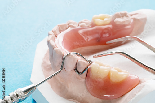 Close up, Artificial removable partial denture or temporary partial denture on blue ground.