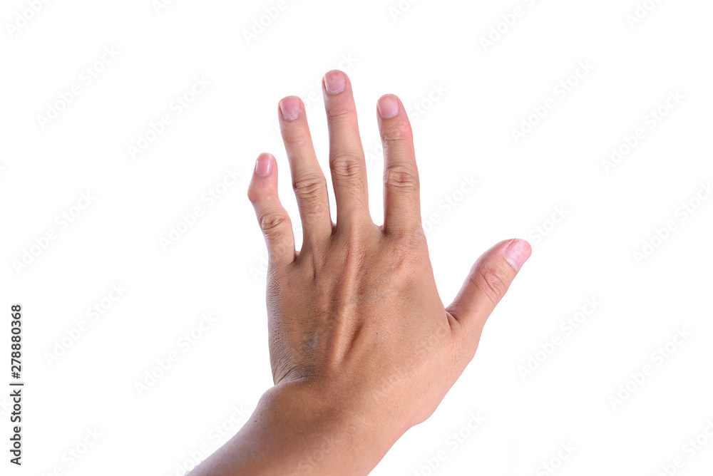 The left hand little finger or pinky finger is deformity isolated on white background. The left hand little finger or pinky finger is deformity isolated on white background.