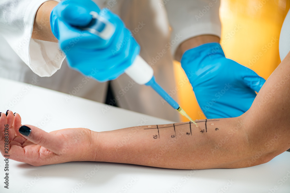 Obraz premium Allergy - Skin Prick Testing