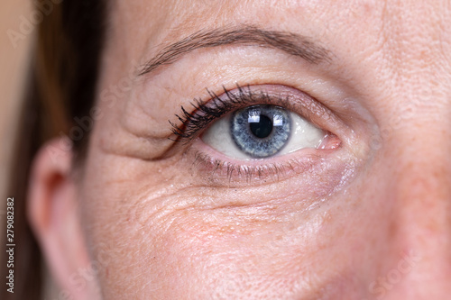 Foto A closeup and front view on the eye area of a lady in her 40s