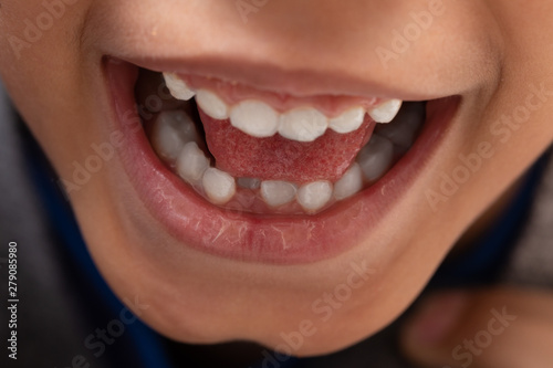 A closeup view on the mouth of a happy kid with a toothy smile. Missing milk teeth are seen as new teeth grow through gums.