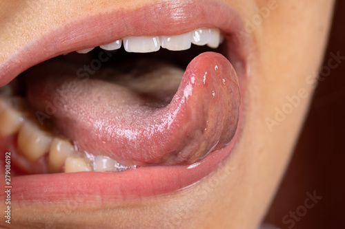 Photo A closeup view on the mouth of a young Caucasian woman sticking her tongue out and curling it up towards the teeth