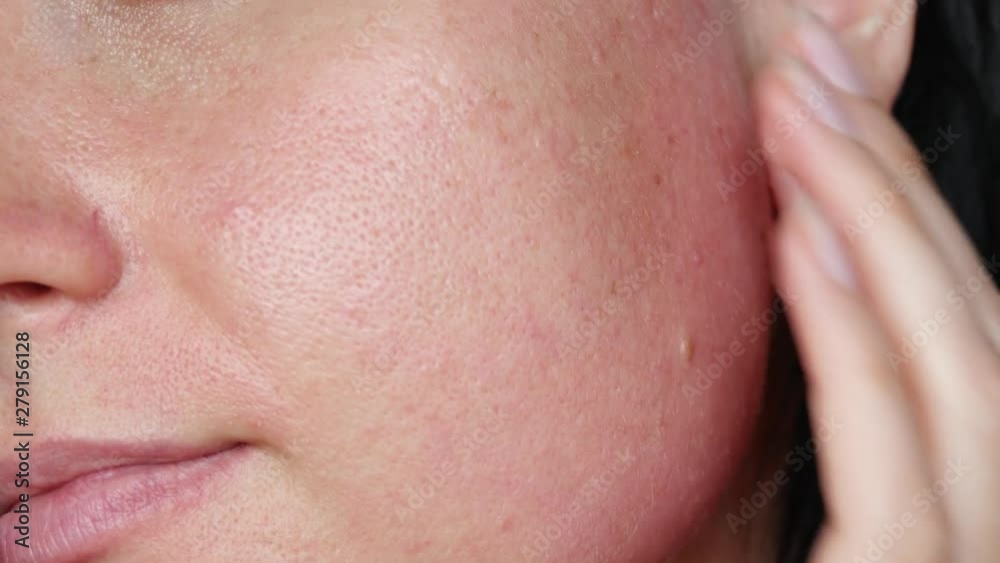 Skin texture with enlarged pores. A woman touches her face, making a massage close-up. Problem skin care, anti-aging care. Skin texture with enlarged pores. A woman touches her face, making a massage close-up. Problem skin care, anti-aging care.