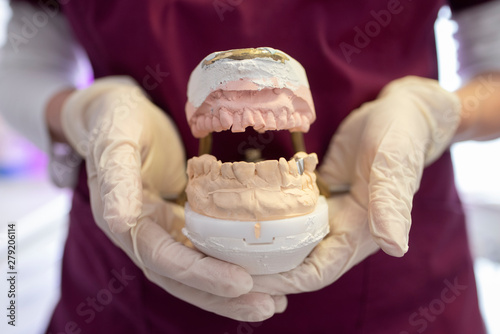 Closeup of dentist assistant showing a dental mold in dental clinic. photo