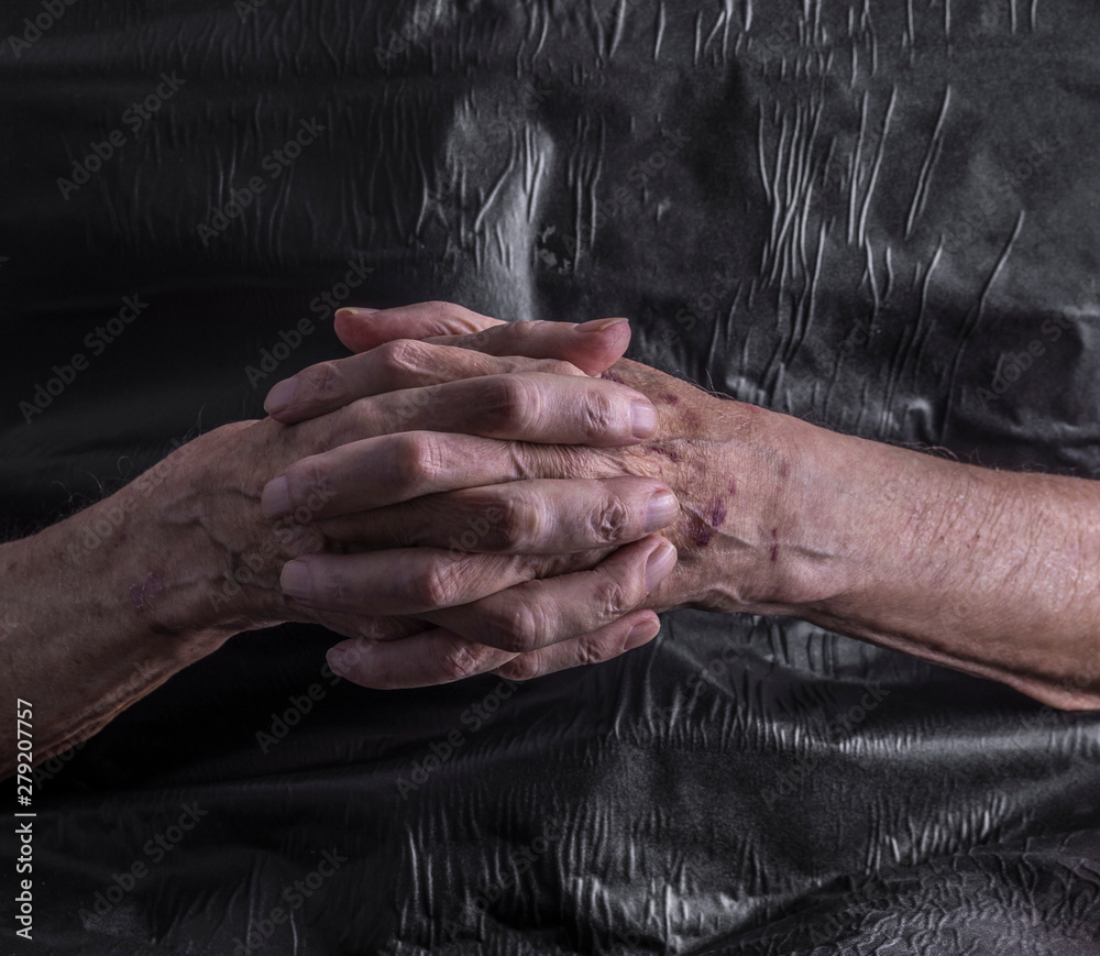 Fototapeta premium old man's sick hands, pensioner