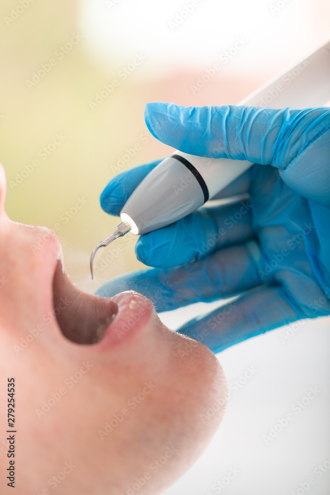 Young man visiting the dental office. Dentist hands in protective gloves using ultrasound to clean patient's teeth. Closeup of open mouth.