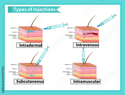 Scientific medical illustration of types of injections